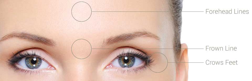 Anti-Wrinkle Treatments banner image