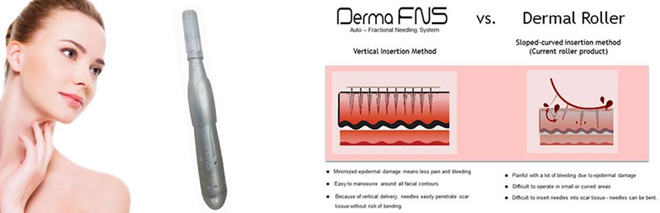 Automated Fractional Dermal Needling Techniques banner image